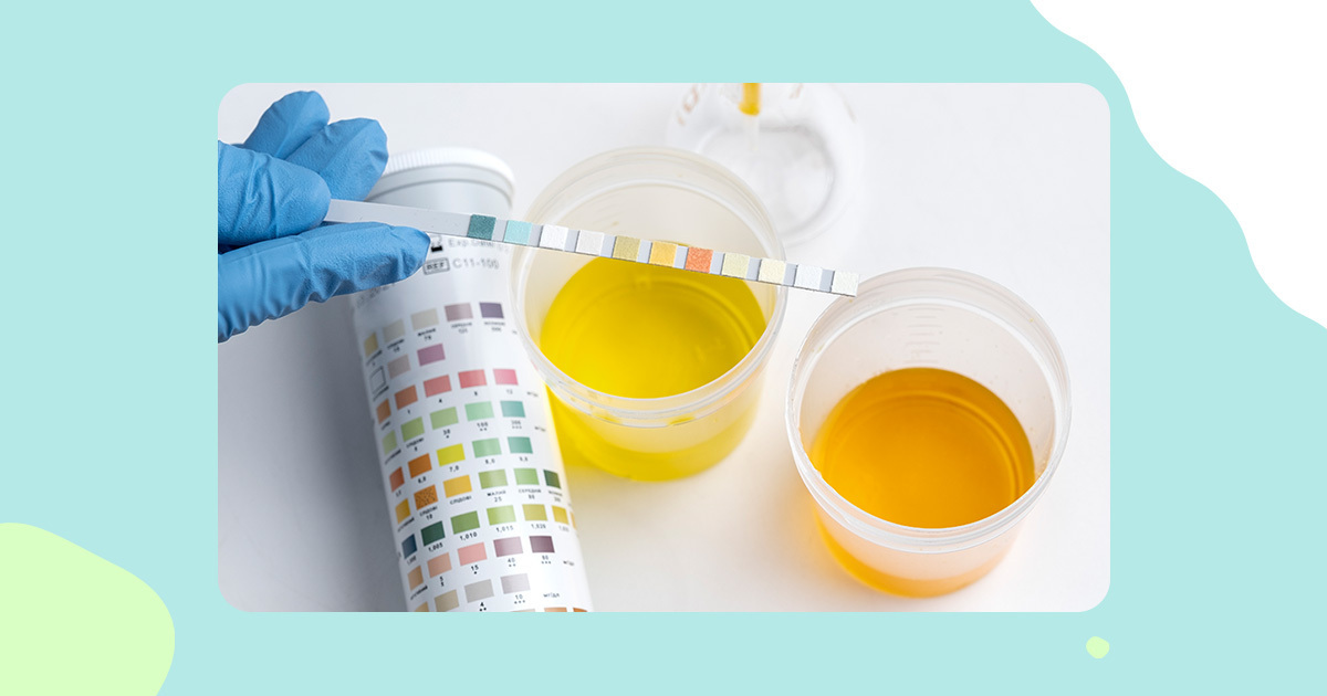 changes in urine color,early signs of pregnancy