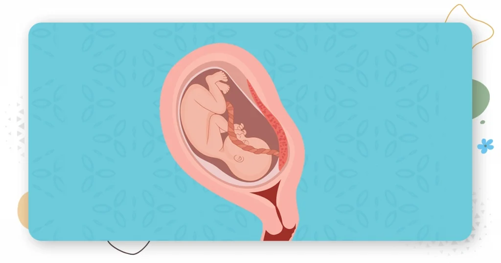 causes of the low lying placenta 