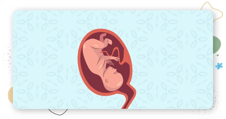 Naturally Moving Your Placenta Up During Pregnancy: Tips and Techniques
