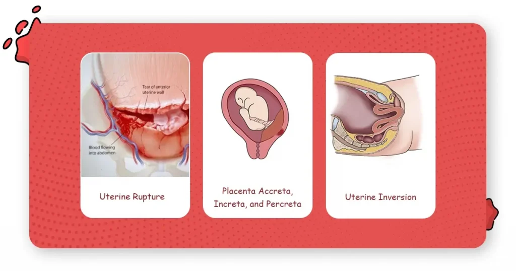 rare causes of postpartum Hemorrhage 