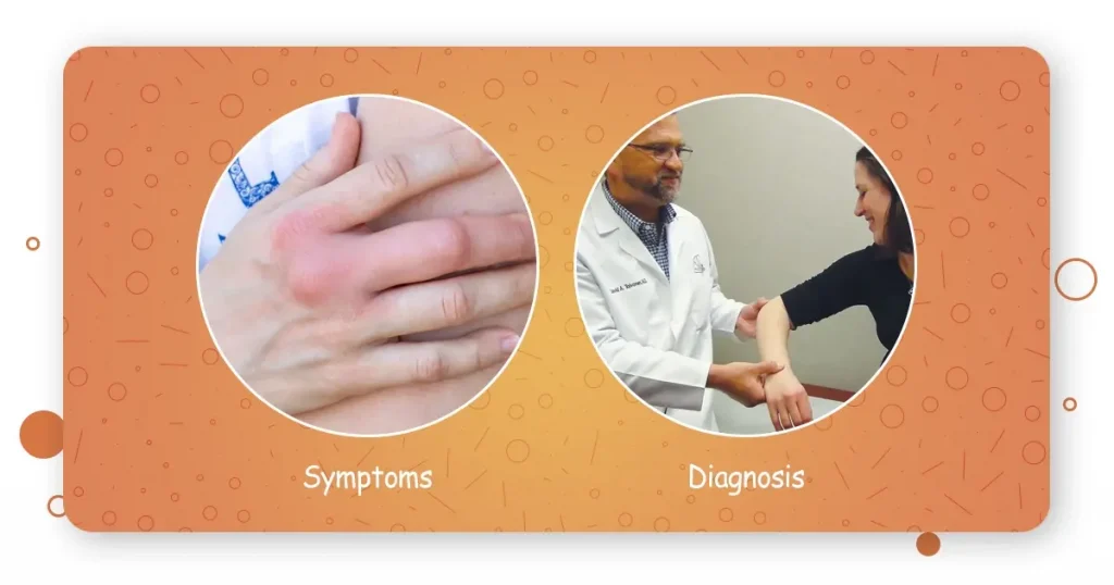 symptoms and diagnosis of wrist pain