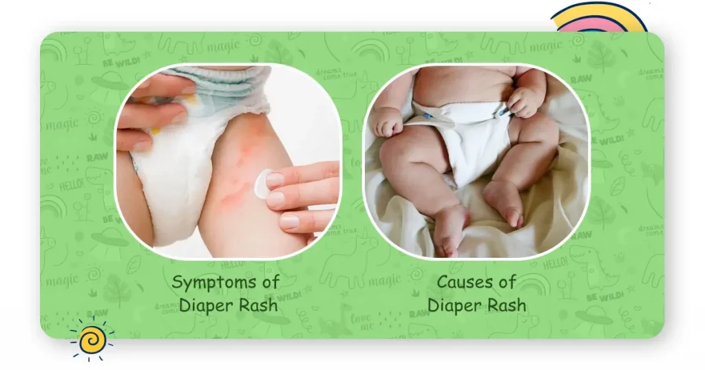 understanding the diaper rashes